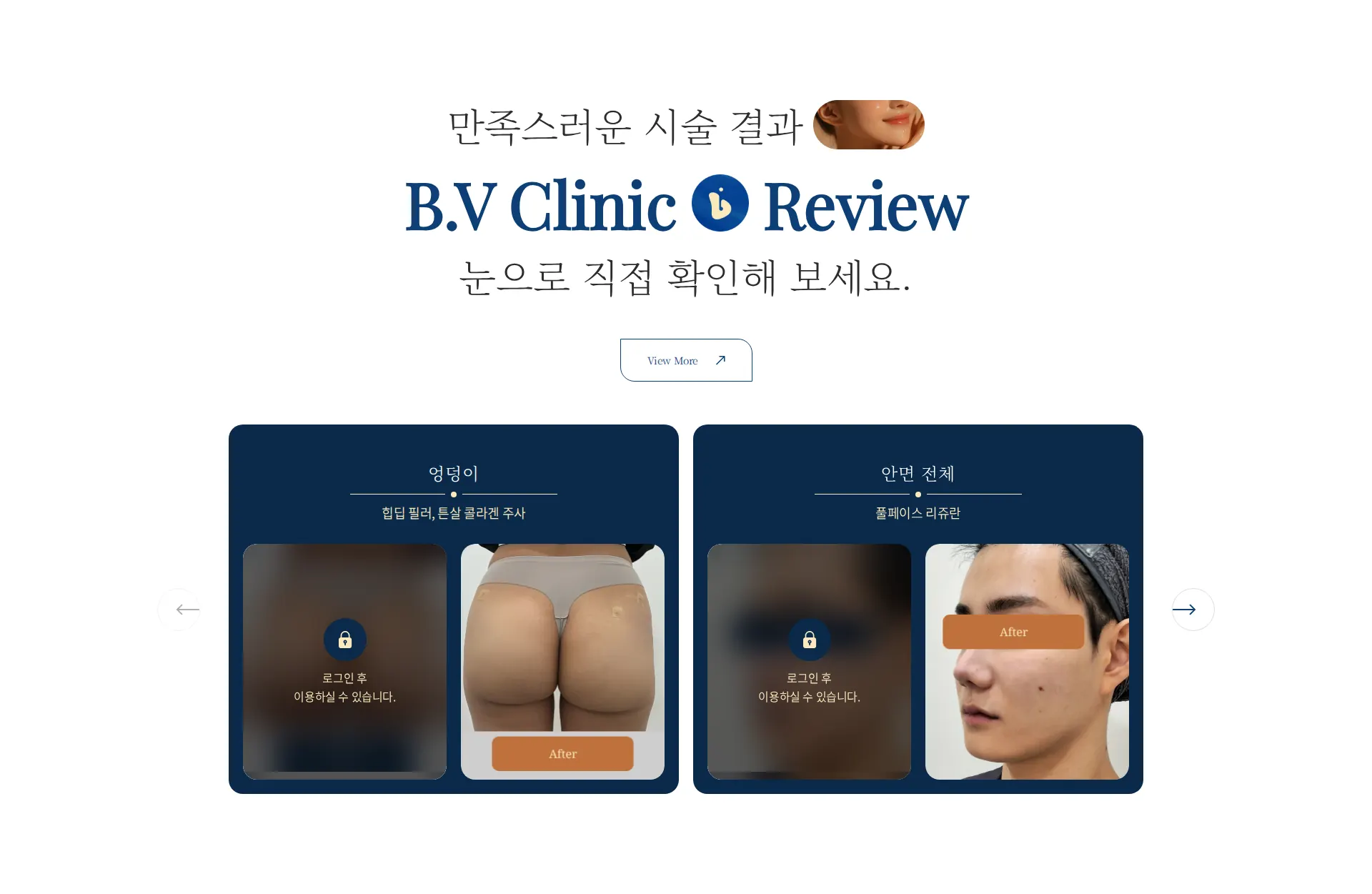 신논현 리프팅·피부 진료 후기 섹션